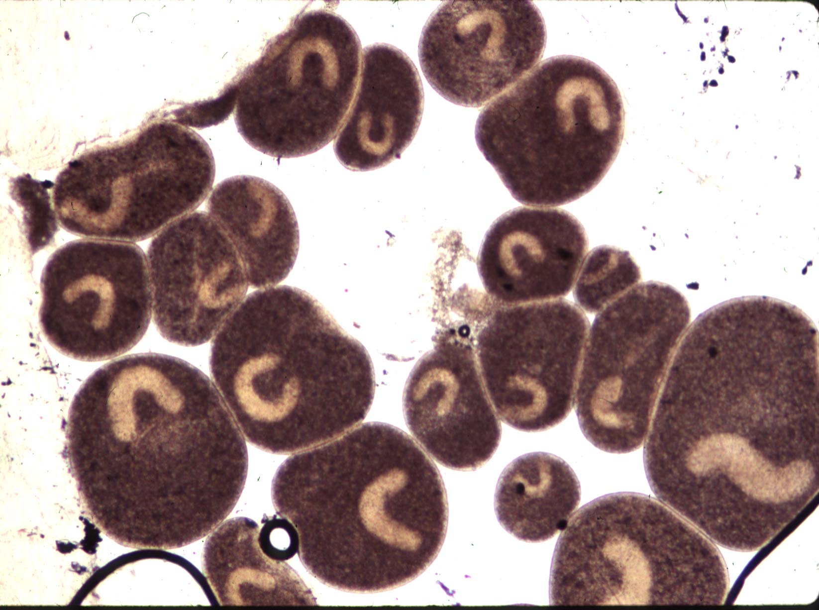 Trofonty Ichthyophthirius multifiliis pod mikroskopem — pasożyt wywołujący kropkowaną chorobę ryb